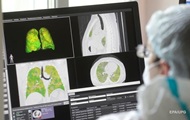 Медики опровергли необратимость последствий COVID-19