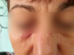 In Sumy, a passenger without a mask beat a trolleybus conductor