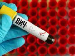 How people with HIV suppress the virus without treatment: a study