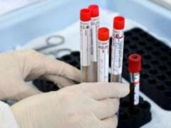Половина пациентов с симптомами COVID-19 в реальности не больны