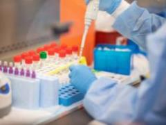 Ministry of Health will attract private laboratories for testing for COVID-19