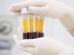 Stepanov announced an experimental project for the treatment of COVID-19 with blood plasma