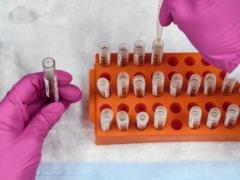 Получены новые доказательства связи тяжести COVID-19 с группой крови