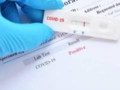 British scientists have created a test to predict the severe form of COVID-19