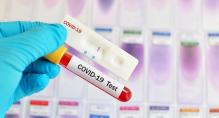 Infectious diseases, why PLR testing on  