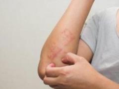 How to recognize early symptoms of leukemia