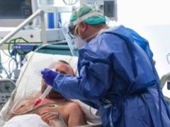 Antibodies to covid were found in the blood of patients who did not have covid