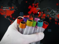 Украина на 17 месте в глобальном списке стран по количеству подтвержденных случаев коронавируса