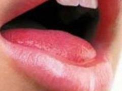 How to stop excess saliva flow