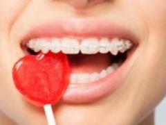 7 привычных продуктов, которые вредят нашим зубам