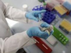 Ukraine will expand the circle of people who will be tested for coronavirus