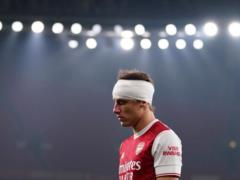 IFAB одобрил тестирование дополнительных замен в случае травм головы у игроков