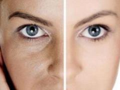 How to shrink pores on your face at home: golden rules for skin care