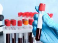 Ukraine expects to receive a batch of vaccine against coronavirus twice as much as planned