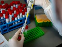 За сутки в Харьковской области зафиксировали 412 случаев COVID-19