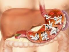 When parasites invade, intestinal cells raise the alarm