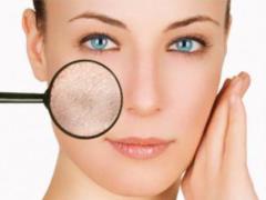Dryness, pigmentation and other skin problems in winter