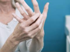 What Indicates Rheumatoid Arthritis? Experts name two unexpected signs