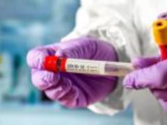 In Kiev, over the past day, 547 cases of coronavirus infection
