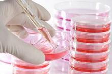 Research: Decreased KRAS Gene Activity May Help Fight Pancreatic Cancer
