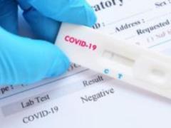 В Украине проведут тестирование на наличие антител к COVID у населения