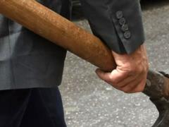Дядя отрубил пальцы пятилетней племяннице за сломанный планшет