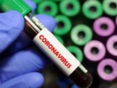 В Украине за сутки обнаружили 417 инфицированных