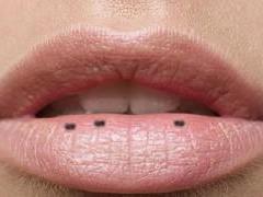 Lip stains may indicate high blood cholesterol levels