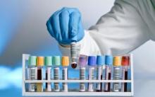 Scientists have found an unusual way to protect against infections