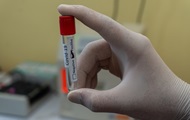 Назван способ избежать тяжелого течения COVID-19