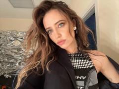 Надя Дорофєєва розповіла про свою пухлину та вперше показала шрам на грудях