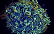 Scientists successfully test HIV vaccine in Japan
