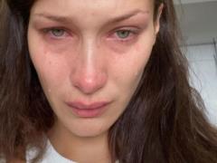 Заплаканная Белла Хадид впервые рассказала о психологических проблемах