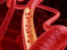 Sucralose leads to blood cancer