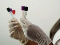 In Ukraine, the first suspicion of infection with Omicron was recorded
