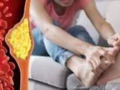 High cholesterol: hair loss in three specific areas of the body can be a sign
