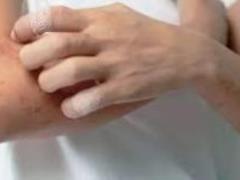 Необычный симптом: зуд в глаза может указывать на заражение Омикроном