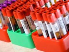Named the blood type that provides the strongest immunity
