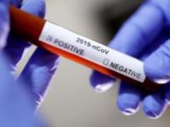 How not to get sick with SARS, covid or colds - recommendations for migrants