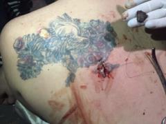 The fragment passed through the Crimea tattooed on his shoulder: Azovstal defender shared a poignant photo