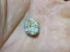 Scientists discover 130,000-year-old Denisovan tooth in Laos