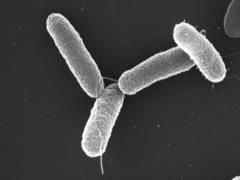 Salmonella in Kinders: Ferrero recalls certain batches from Ukraine – State Food and Consumer Service