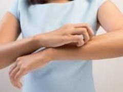 You have a rash or itching? How to recognize monkeypox