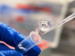 У МОЗ оцінили ймовірність поширення мавпової віспи в Україні