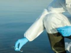 No cases of cholera recorded in Ukraine - Ministry of Health