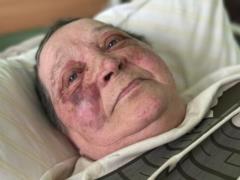 In Kherson, the invaders broke the spine of a 70-year-old woman for refusing to hand over her Ukrainian passport