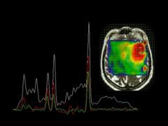 Magnetic resonance spectroscopy (MRS): what is it and how does it work