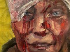 Choreographer from Chuguev, whose photo became one of the symbols of the war, returned to work after eye surgery