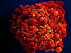 HIV can speed up aging