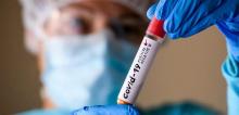 Covid-19 in Ukraine pishov at rist: infection increased by a third in a day
